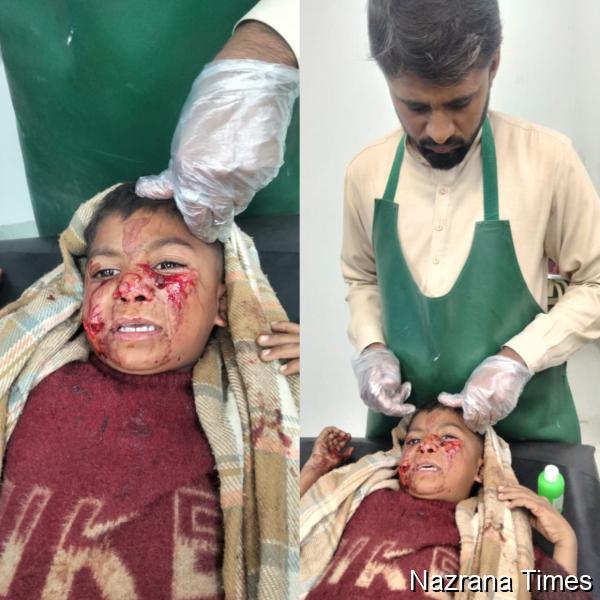 शकरगढ़ सीमा क्षेत्र में सियारों के हमले, दहशत फैली