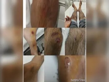 ਪਾਲਤੂ ਕੁੱਤੇ ਕਾਰਨ ਹਾਦਸੇ ’ਚ 12 ਸੱਟਾਂ ਲੱਗਣ ਦਾ ਦਾਅਵਾ, ਪੀੜਤ ਨੇ ਸਰਹਾਲੀ ਕਲਾਂ ਪੁਲਿਸ ’ਤੇ ਕਾਰਵਾਈ ਨਾ ਕਰਨ ਦੇ ਲਾਏ ਦੋਸ਼